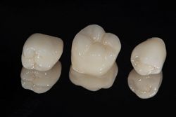 Dental crowns