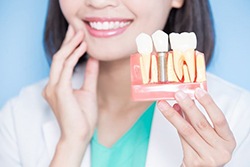 Dentist holding model of dental implants in Plano