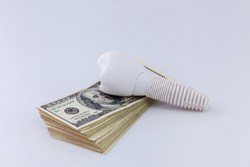Implant and money representing the cost of dental implants in Plano 