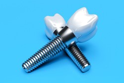 dental implants in Plano on bright blue background    