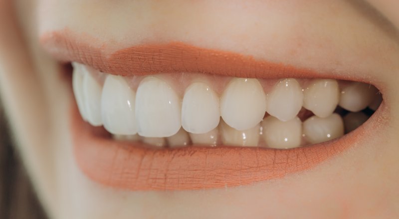 Woman with porcelain veneers in Plano