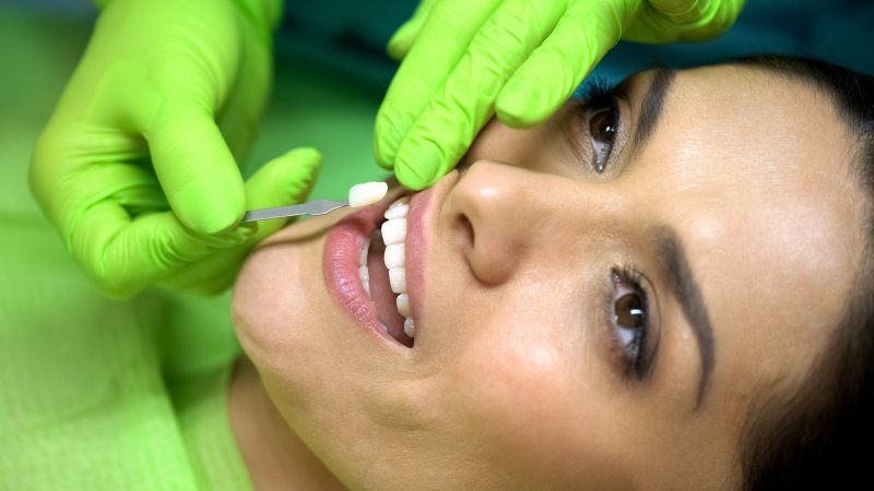 Woman getting porcelain veneers in Plano