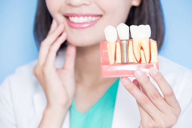 closeup of a model of dental implants 